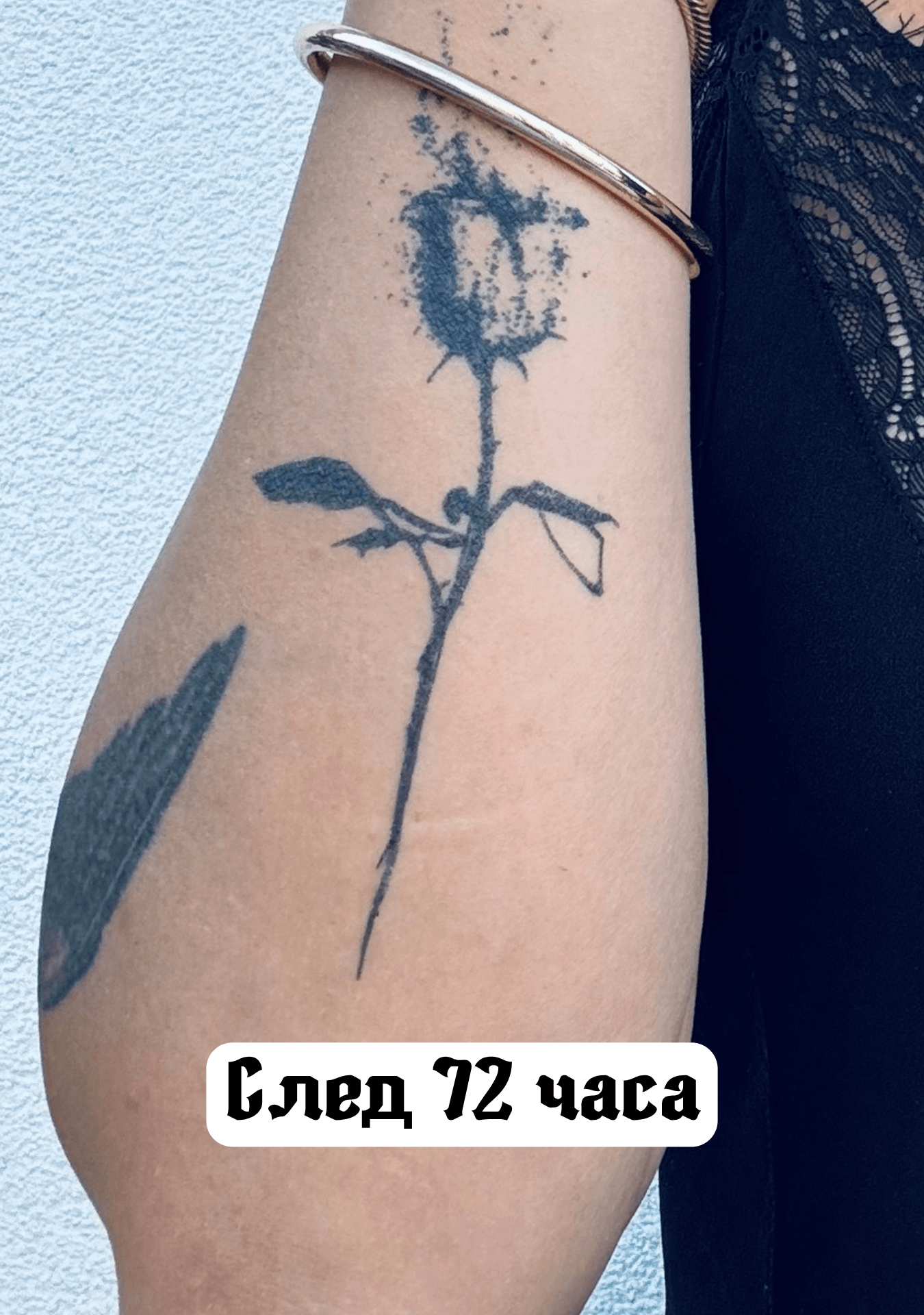 După 72 de ore