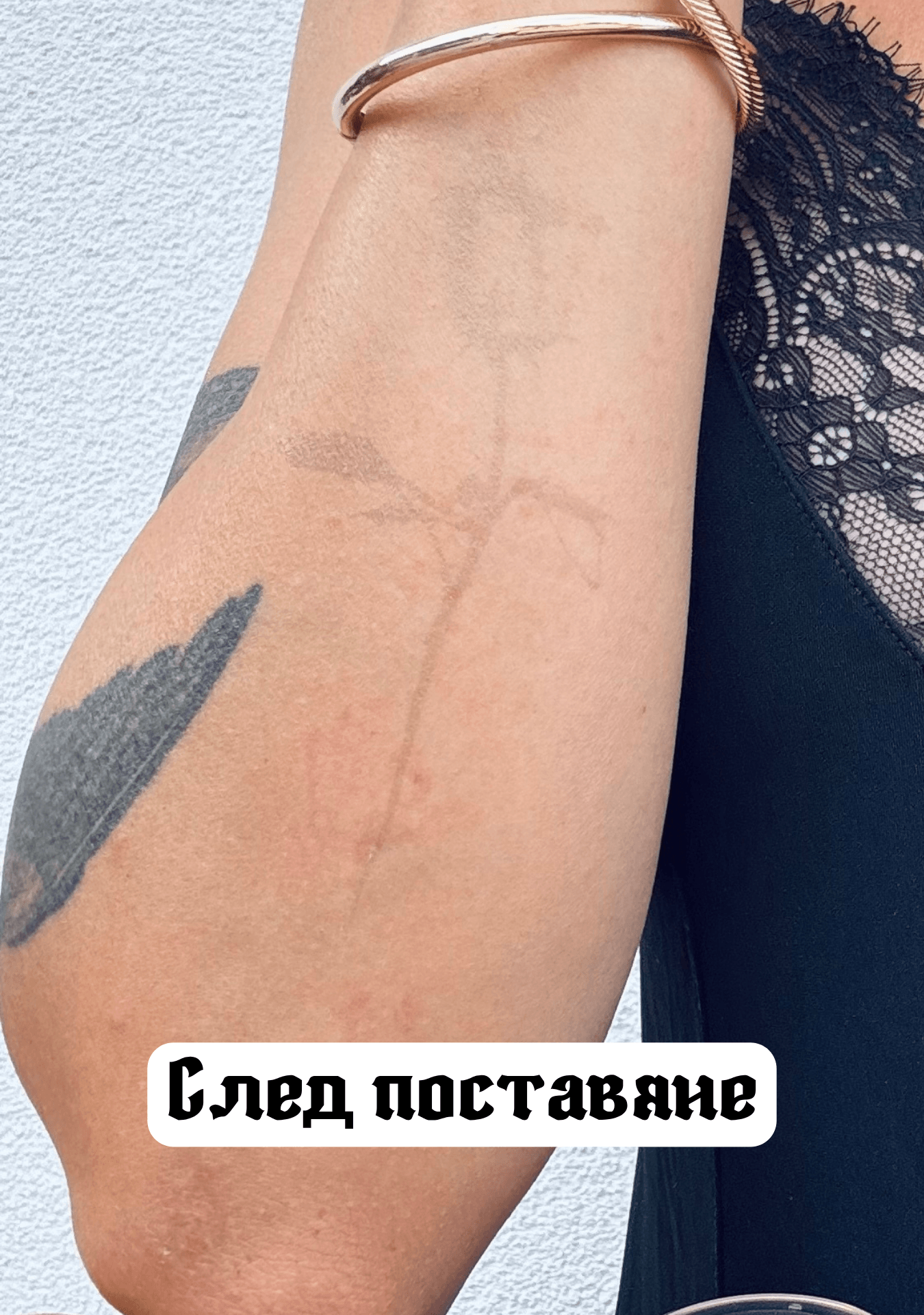 După aplicare