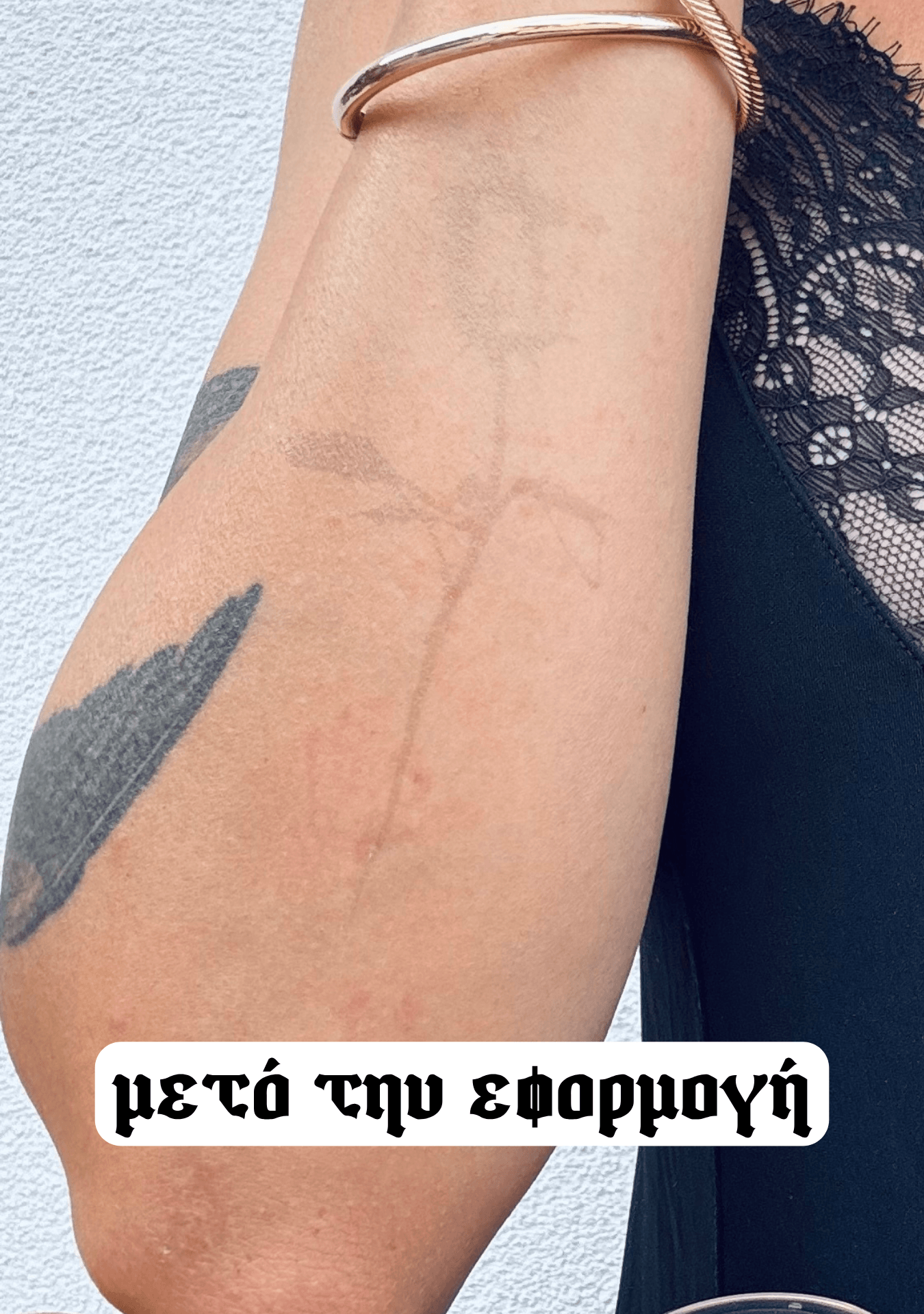 După aplicare