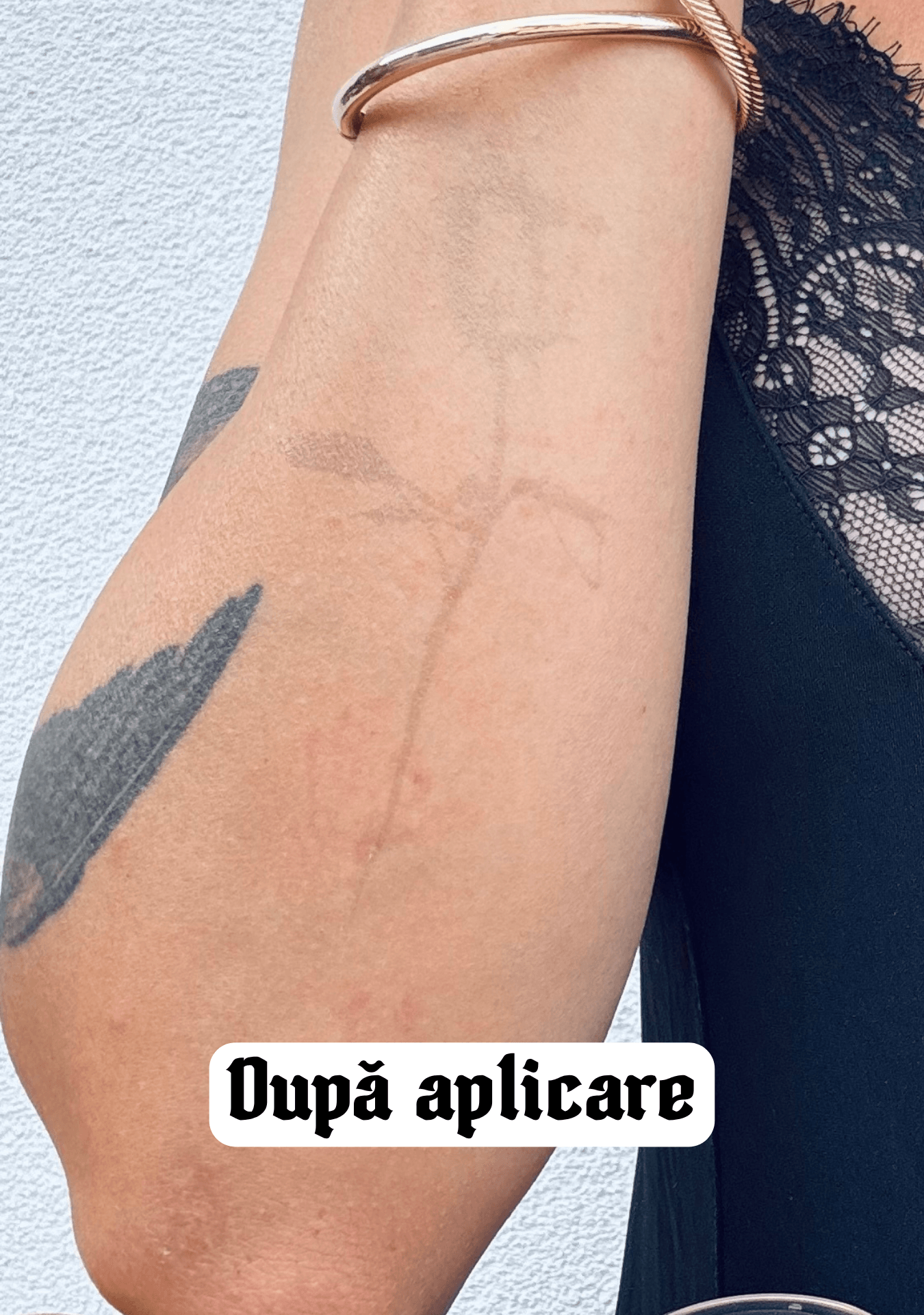 After applying