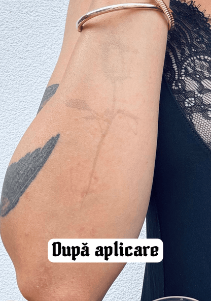 After applying